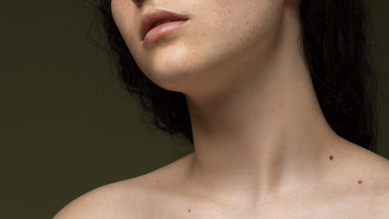 Nahaufnahme des Halses und Kinns einer Person mit leicht sichtbaren Sommersprossen und natürlichen Hauttönen.